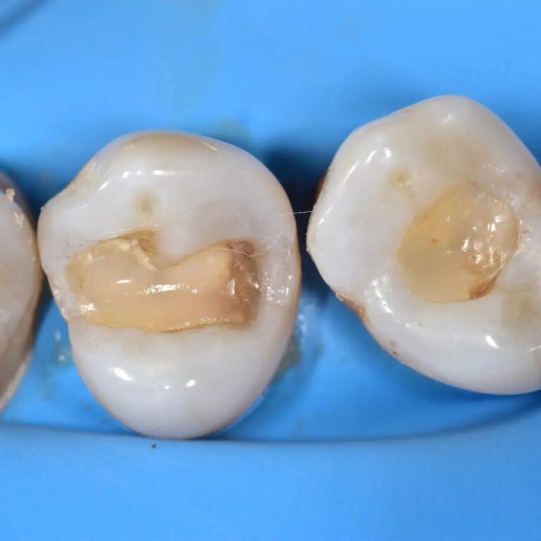 حشوات 3 768x768