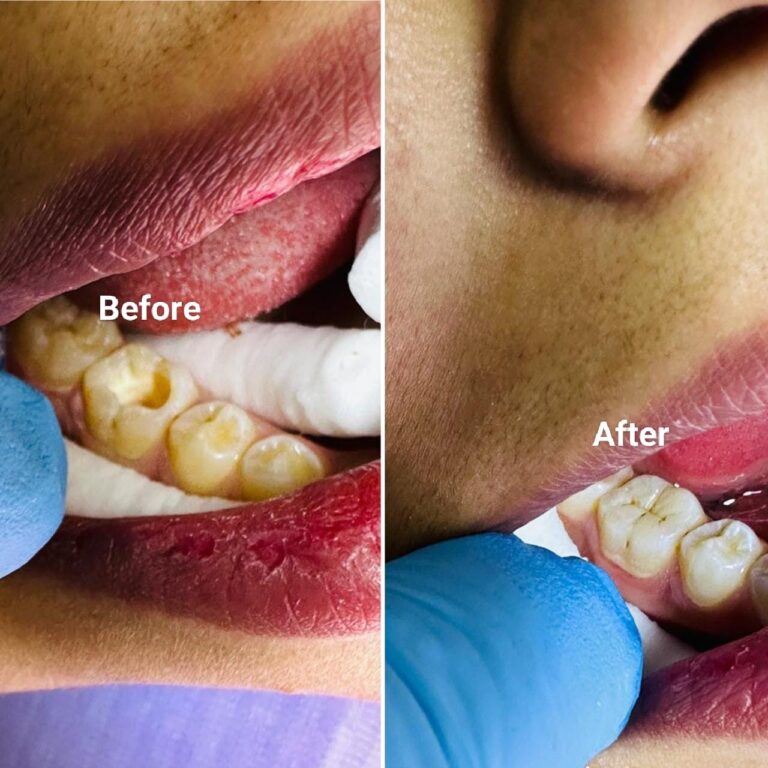 حشوات تجميل 2 768x768