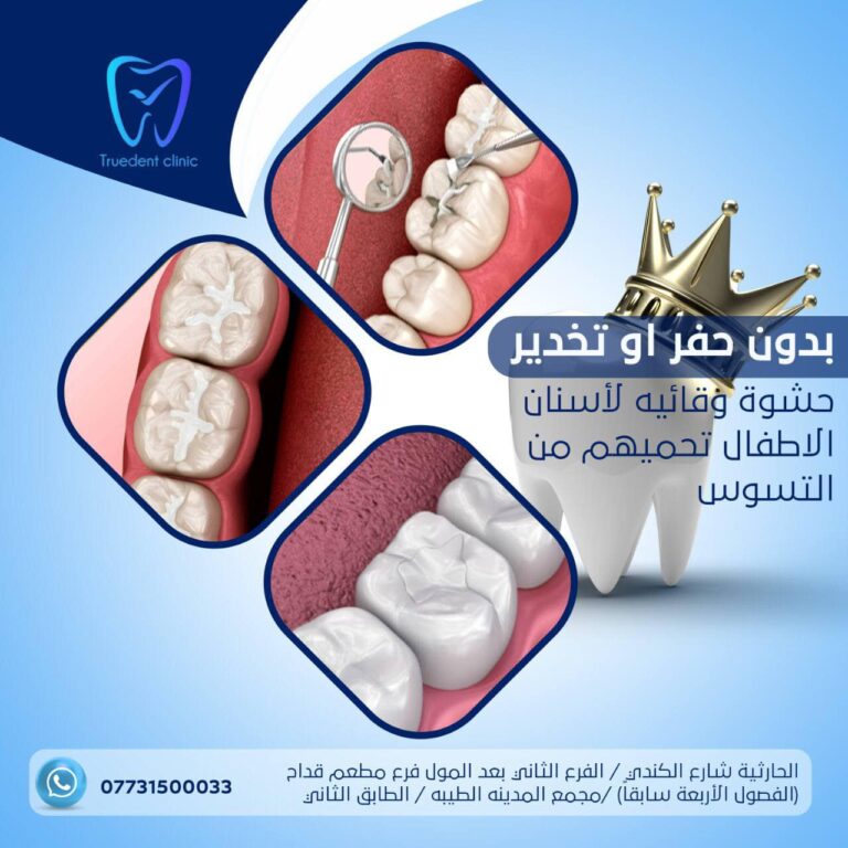حشوات وقائيه 768x768