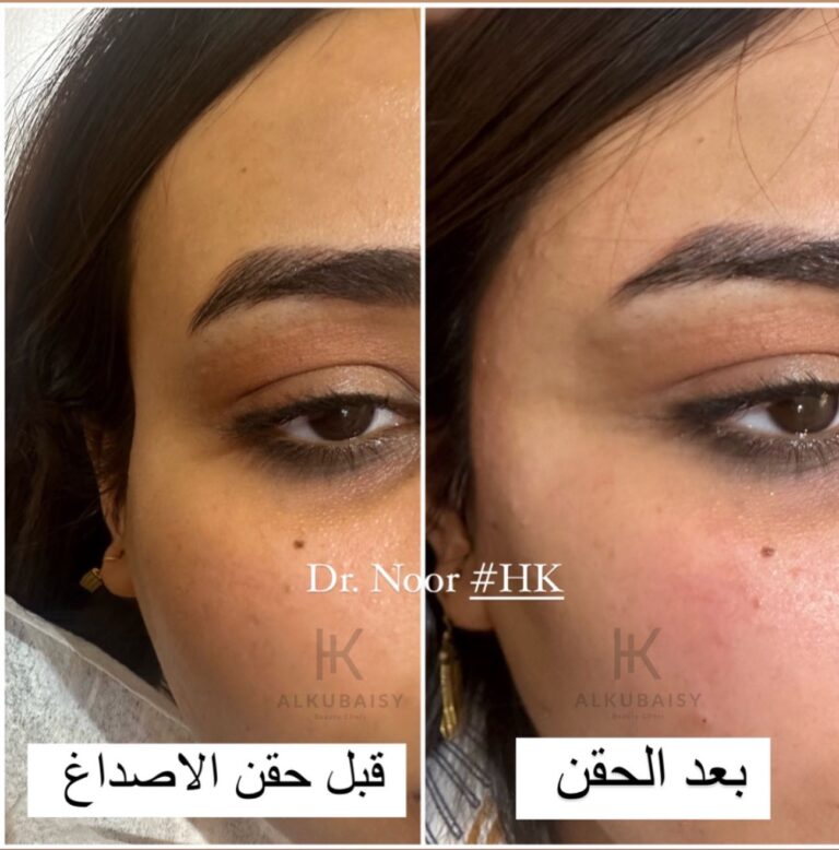 حق الاصداغ 768x778