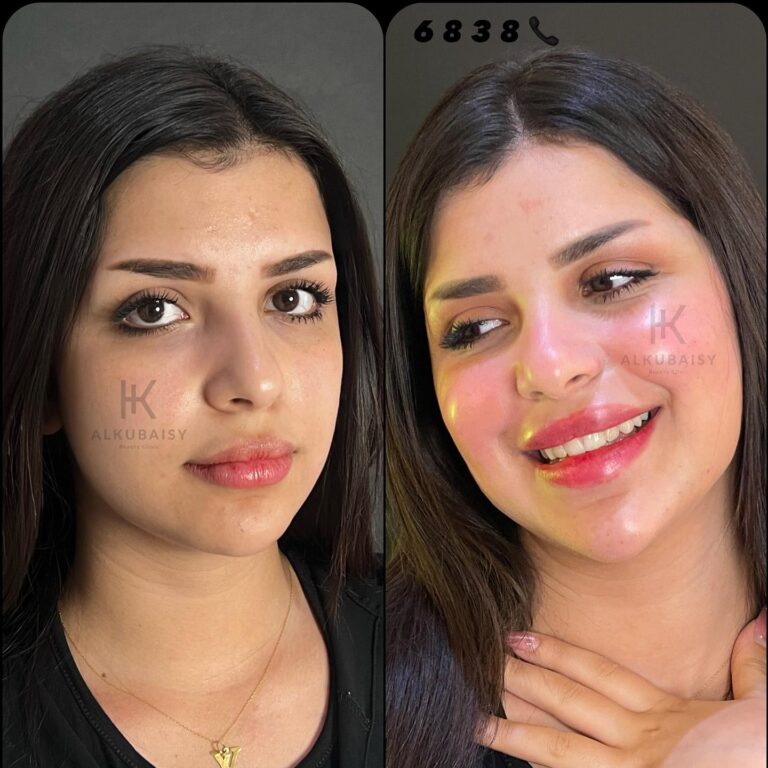 حق الاصداغ والشفه 768x768