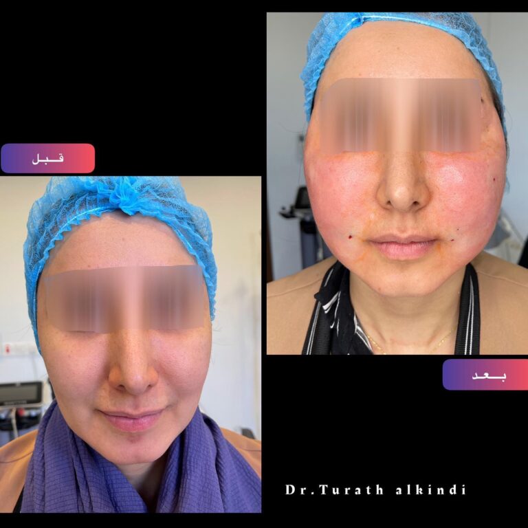 حق شحوم ذاتية 768x768