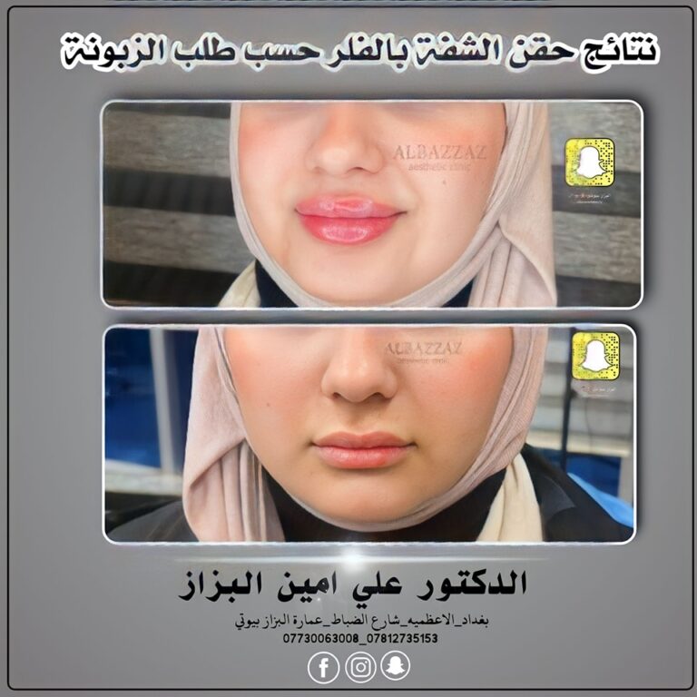 حق شفاه 768x768