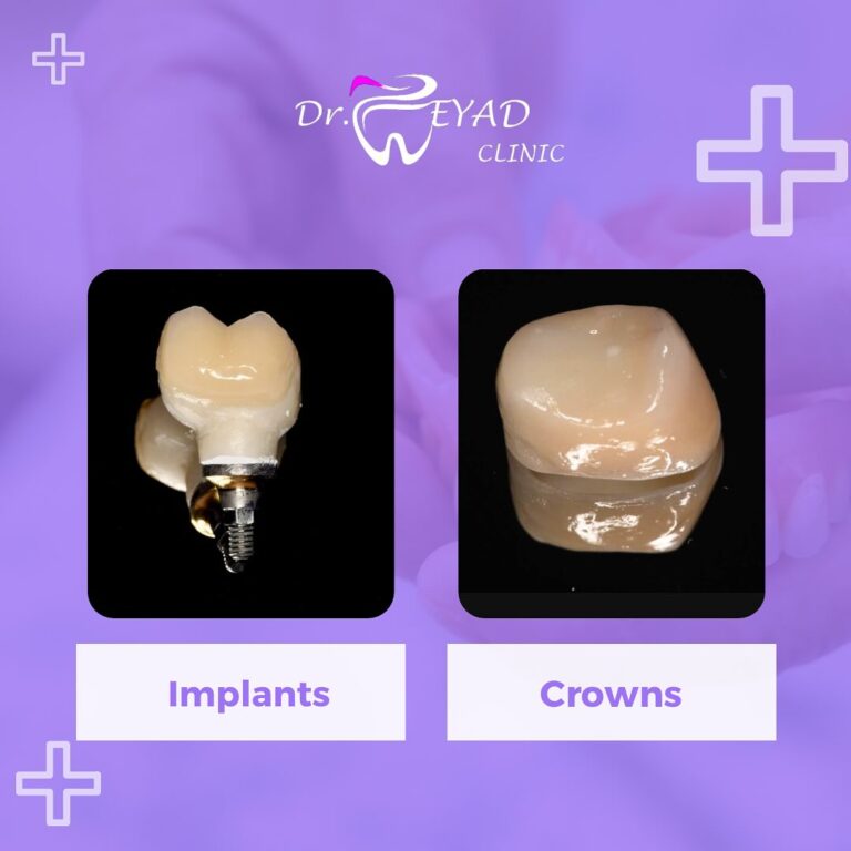 حلول التركيب 768x768