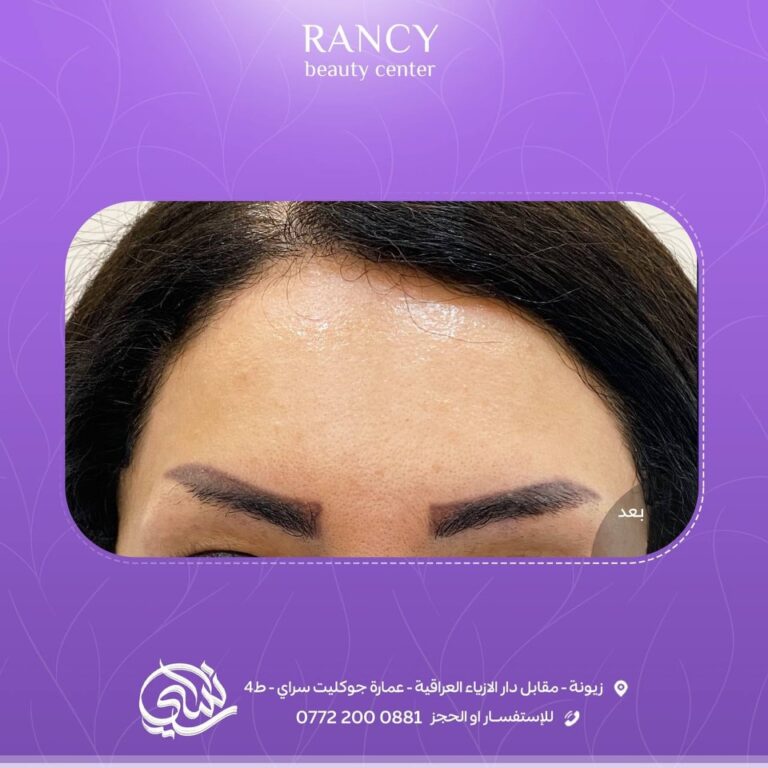 خطوط الجبين 2 768x768