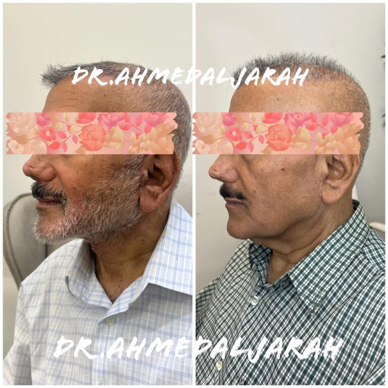 رجال شد وجه 768x768