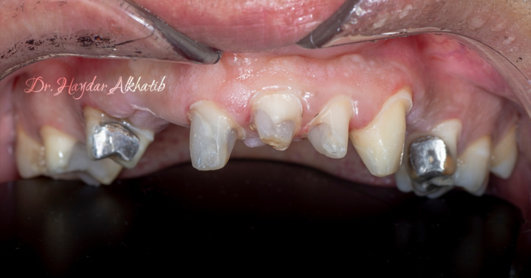 زراعة بشكل احترافي 768x403