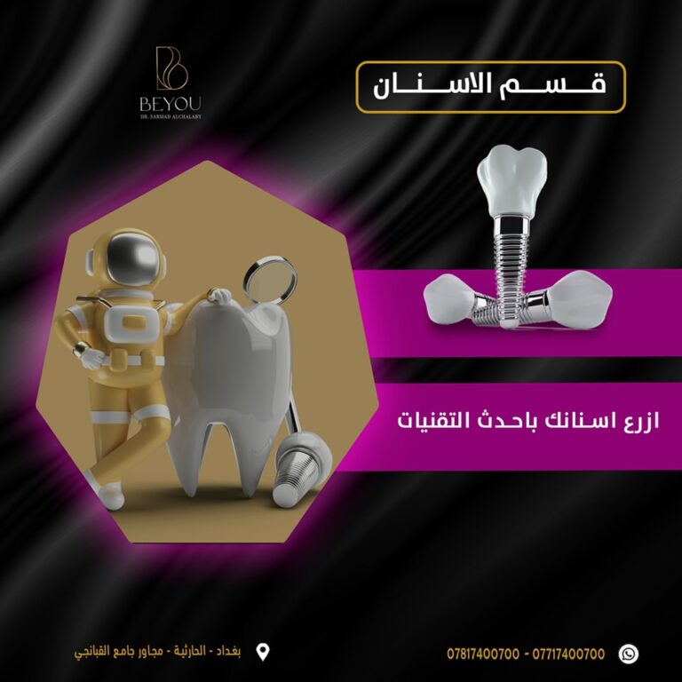 زراعه الاسنان باحدث التقنيات 768x768