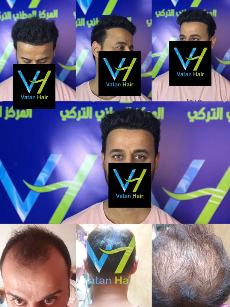 زراعه ممتازه 1 768x1023