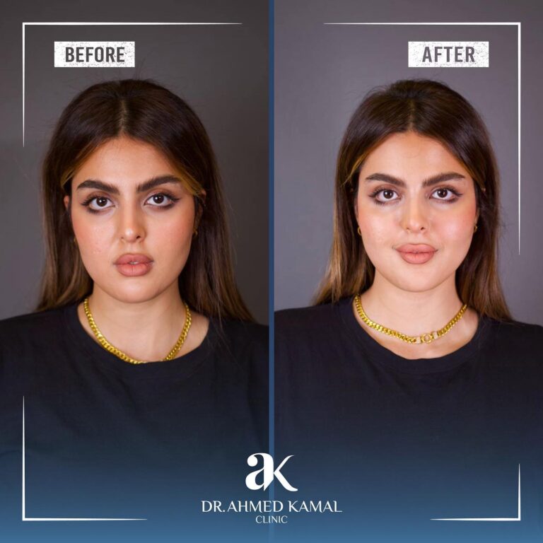 سحب الوجه 768x768