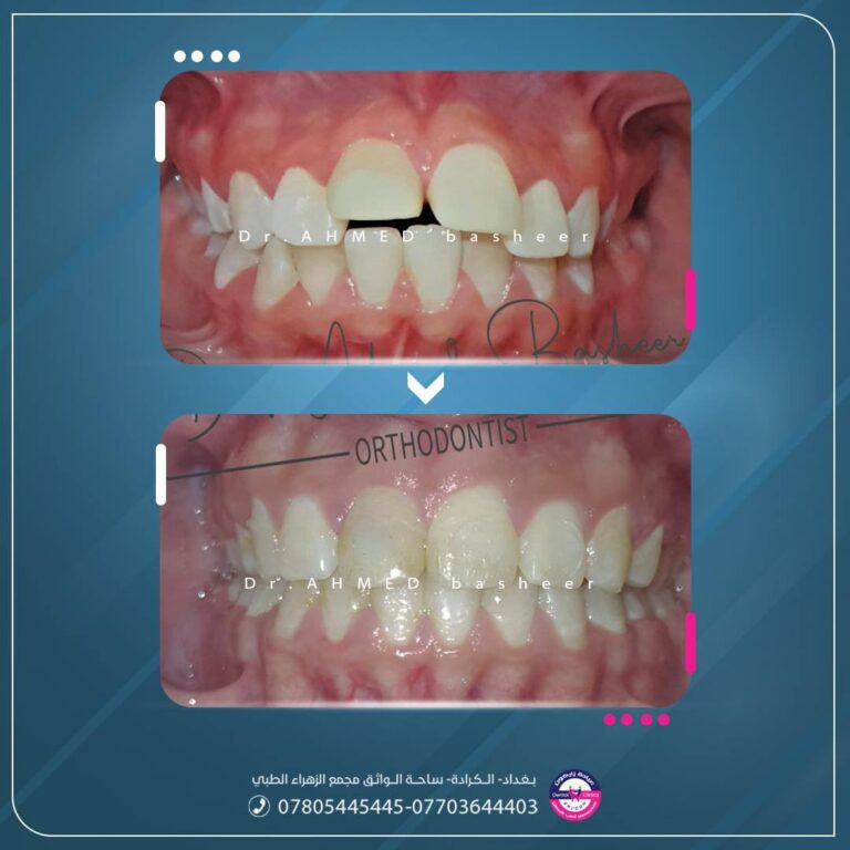 سد الفراغات 768x768