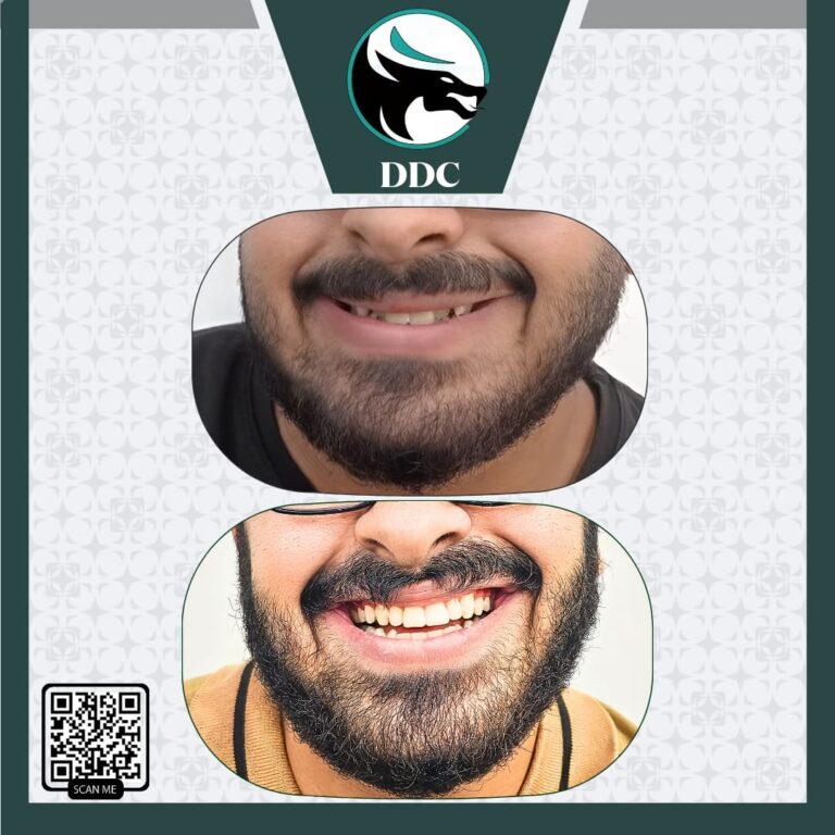 سد فراغات 768x768