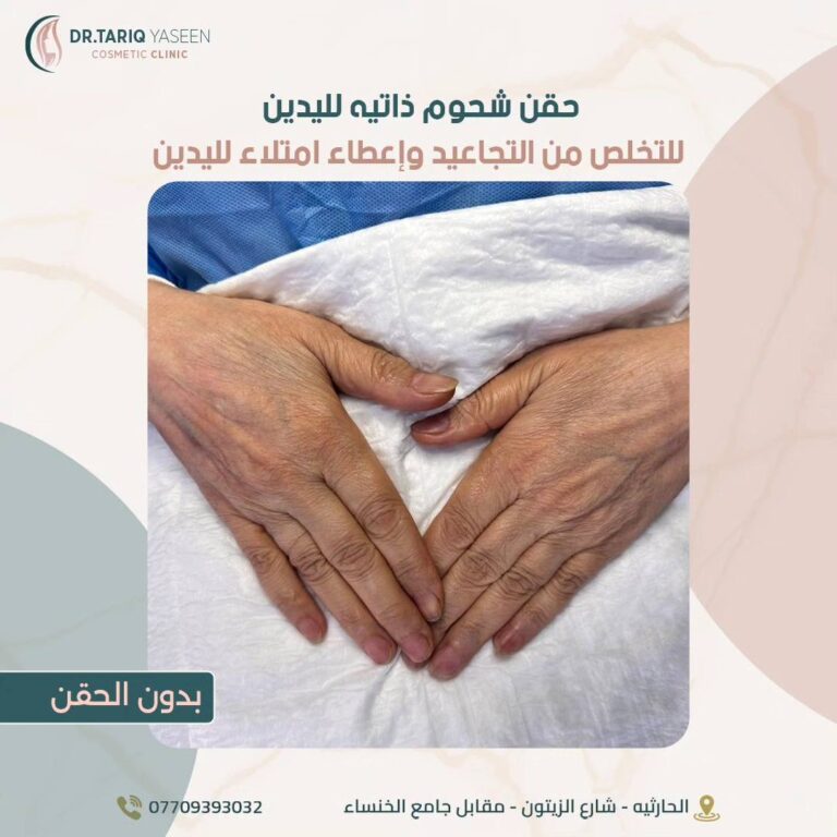 شحوم ذاتيه 768x768