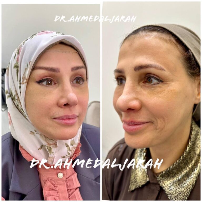 شد الوجه 3 768x768