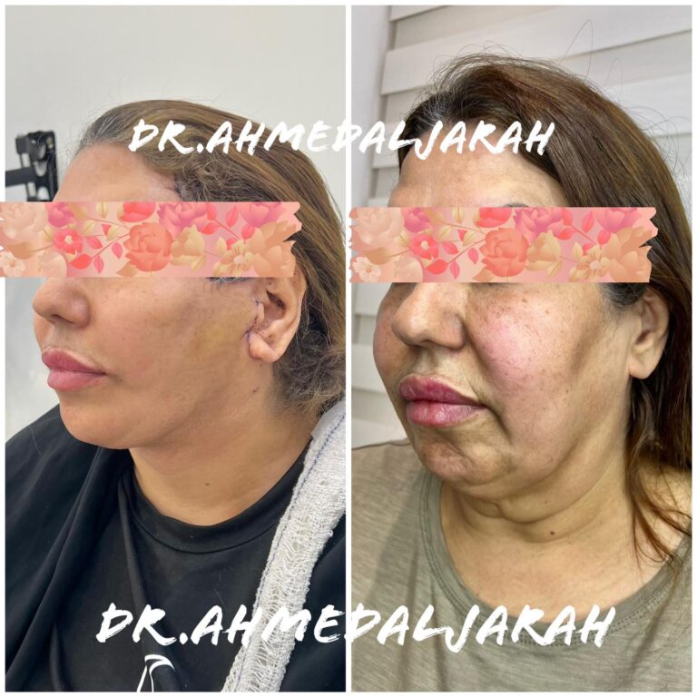 شد الوجه 4 768x768