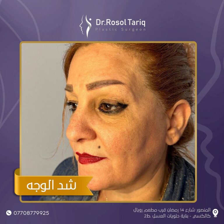 شد الوجه 7 768x768