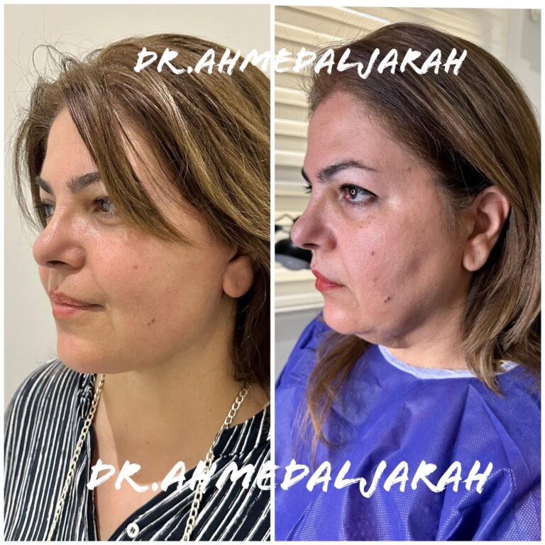 شد بعد 9 اشهر 768x768