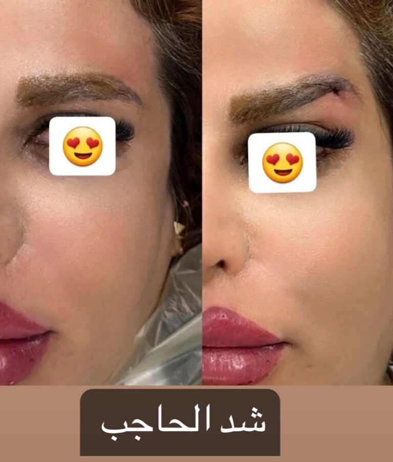 شد حاجب 768x903