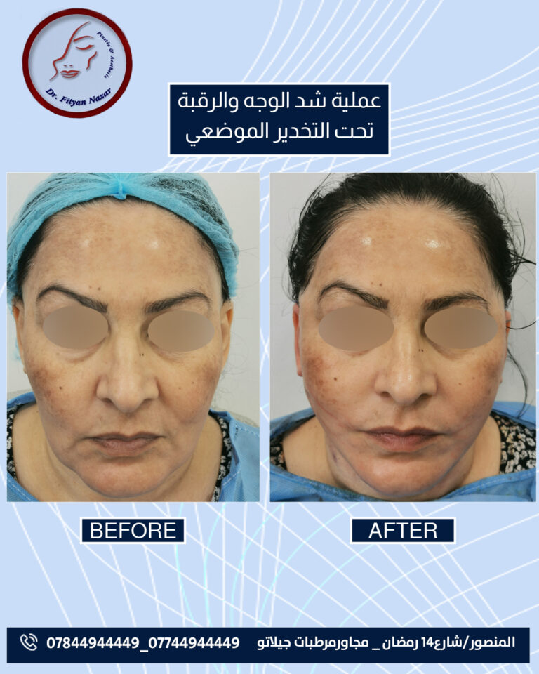 شد وجه 1 768x960