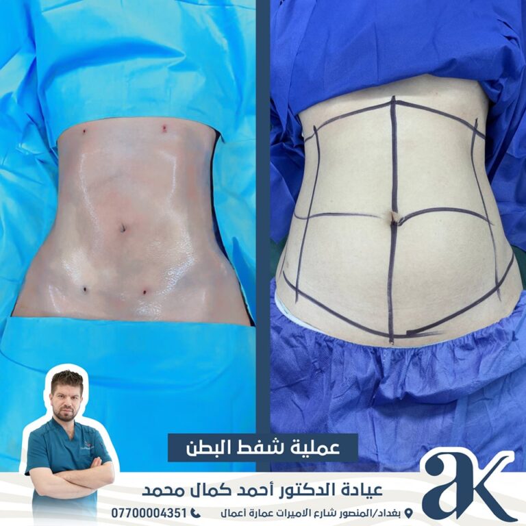 شفط البط 768x768