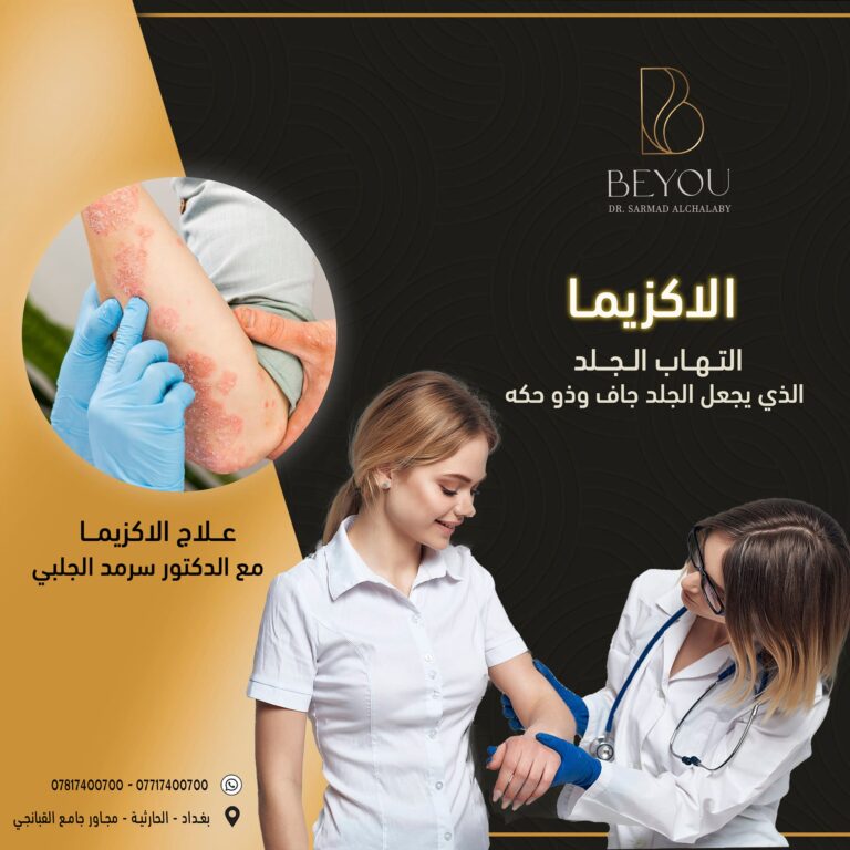 علاج الاكزمه 768x768