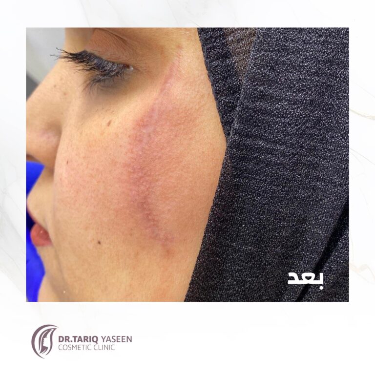 علاج الجروح 768x768