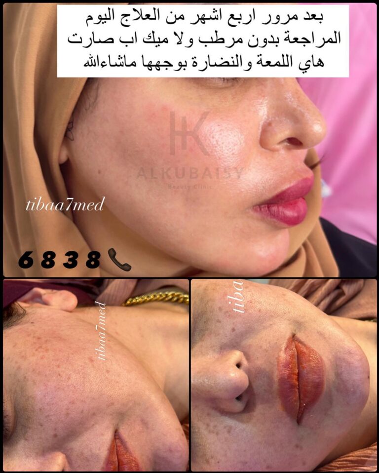 علاج الوجه 768x958