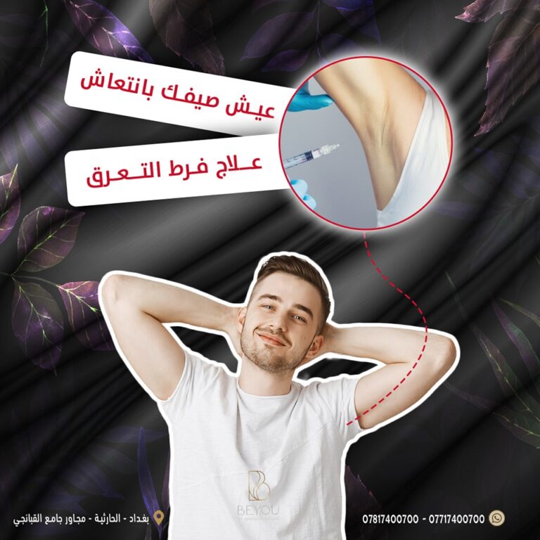 علاج فرط التعرق 768x768