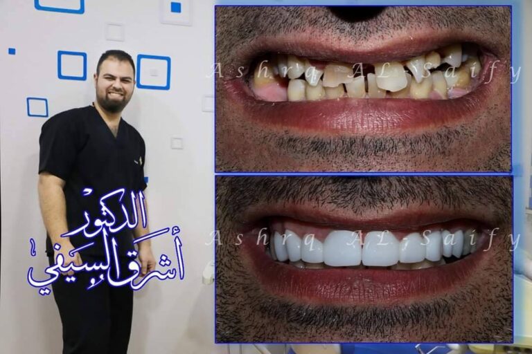 عم انتضام الاسنان 768x512