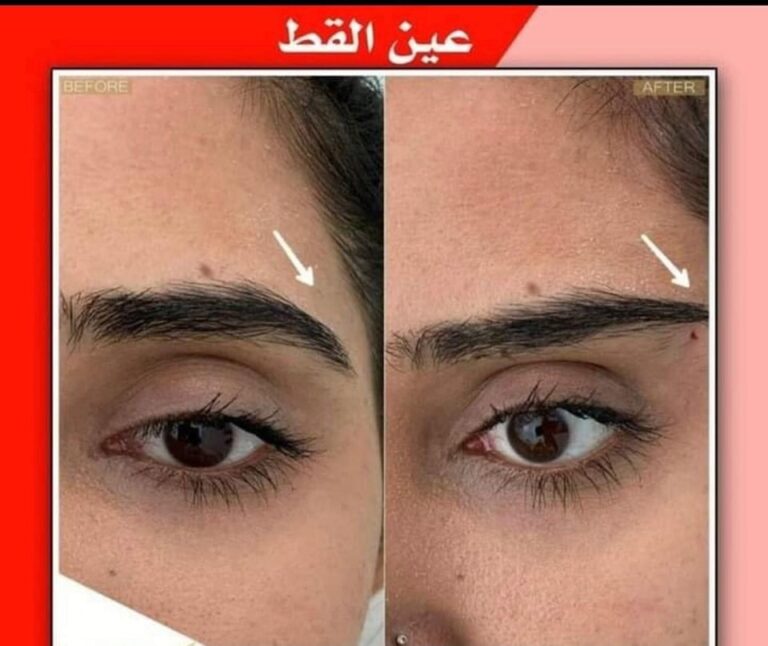 عين القط 768x646
