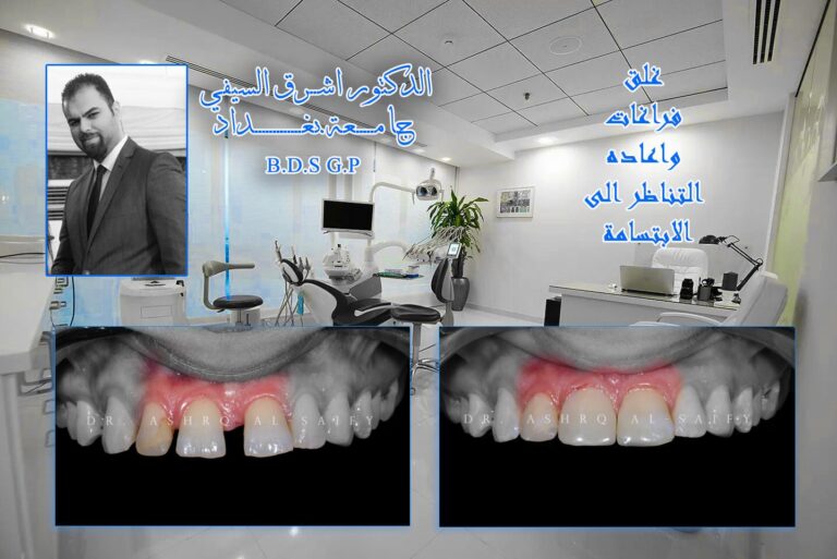 غلق الفراغات 768x513