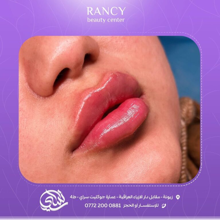 فلر شفاه 16 768x768