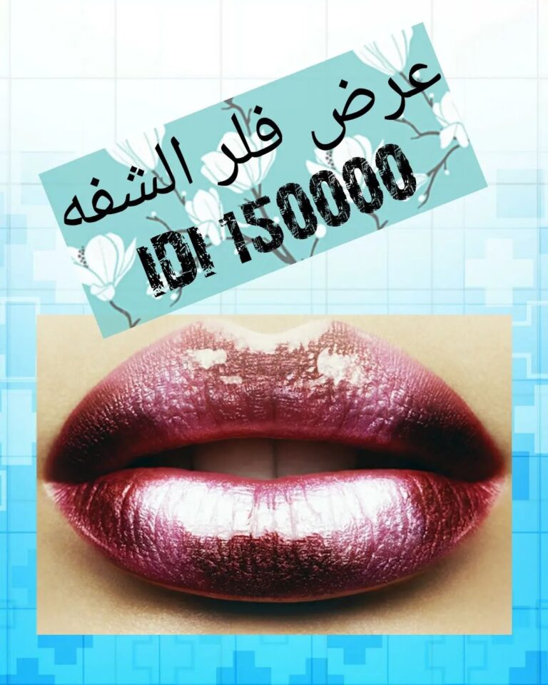 فلر شفاه 3 768x960