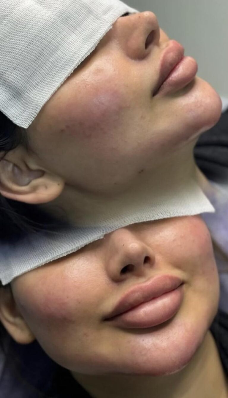 فلر وجه 768x1342