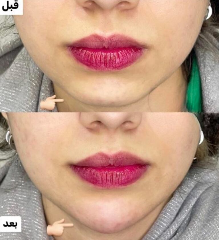 فللر 768x842