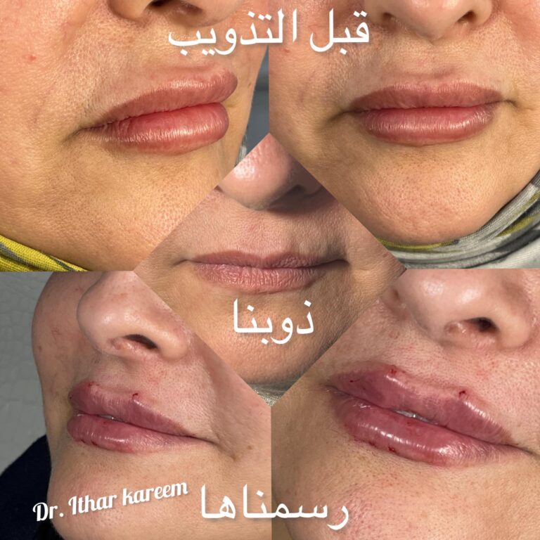 قبل التذويب 768x768