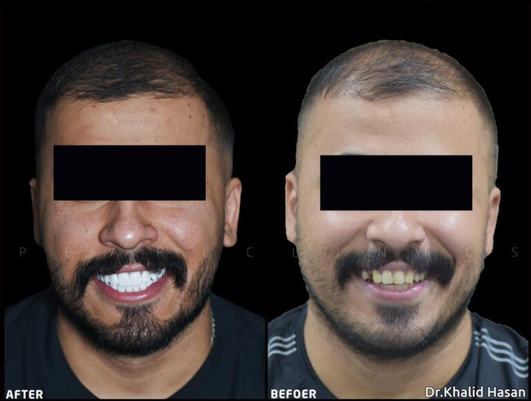 قبل وبعد 2 768x580