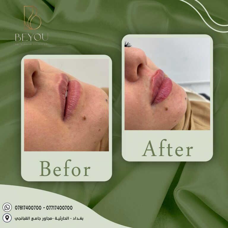 قبل وبعد 768x768