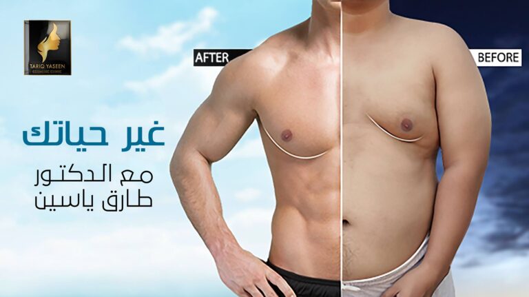 نحت الصدر 768x431