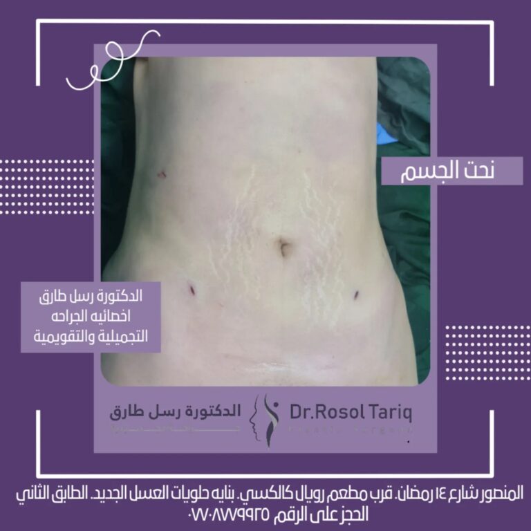 نحتالجسم 768x768