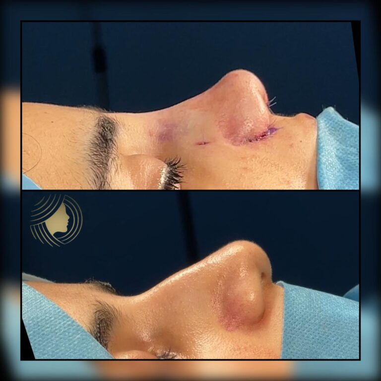 unnamed file 768x768