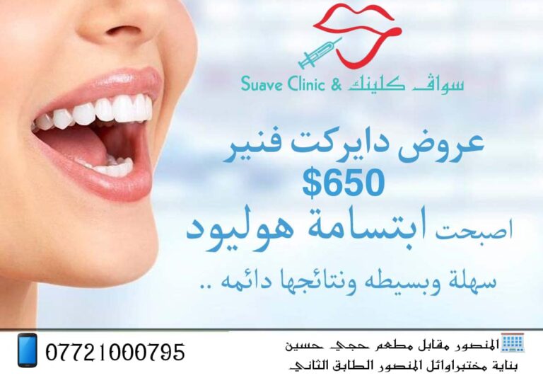 ابتسامة هوليود 768x534