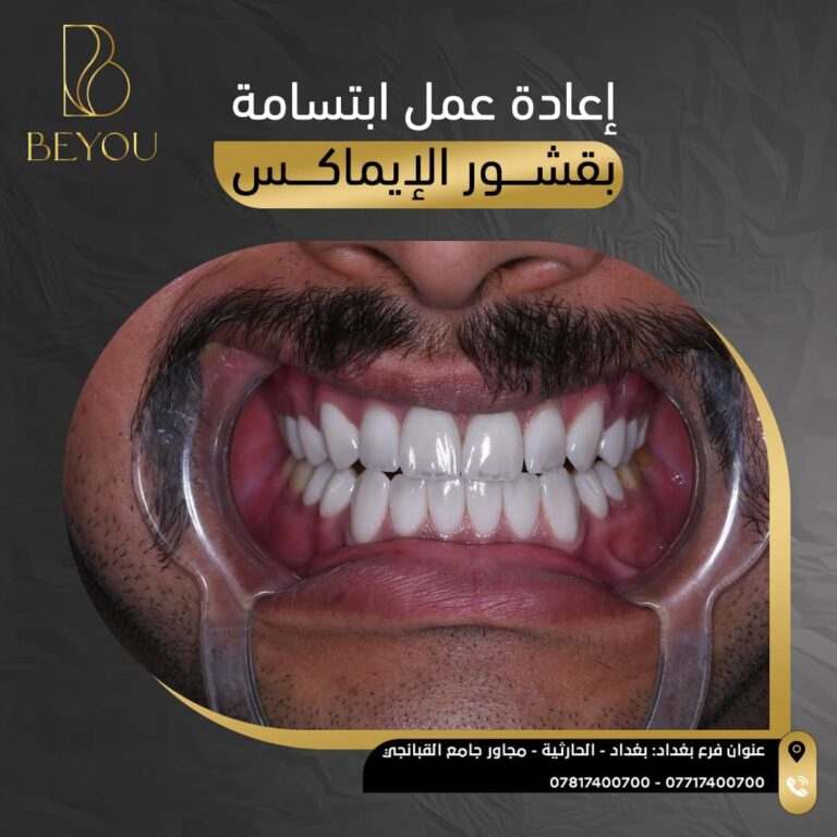 ابتسامه جميله 768x768