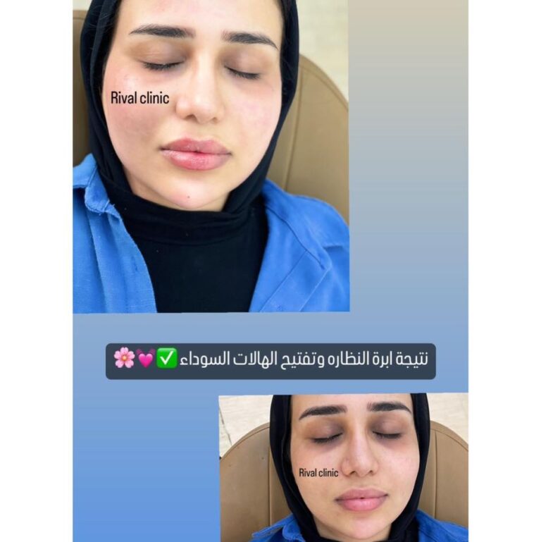 ابره النظاره 768x769