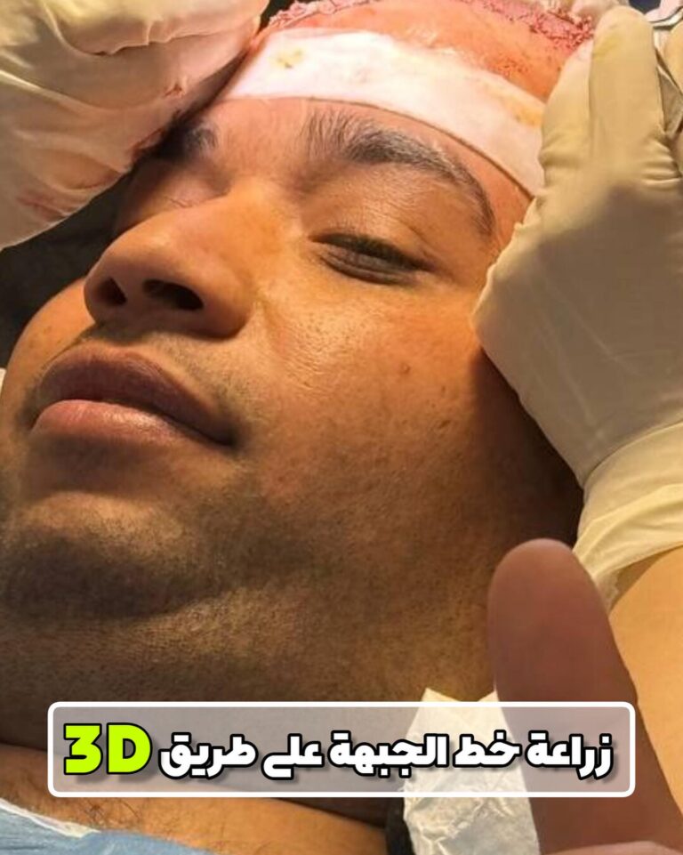 اثناء الزراعة 1 768x961