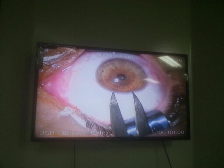 اخذ الخلايا الجذعيه 768x576