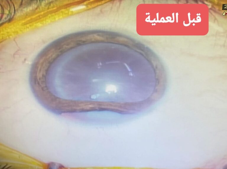 ازالة الماء 768x573