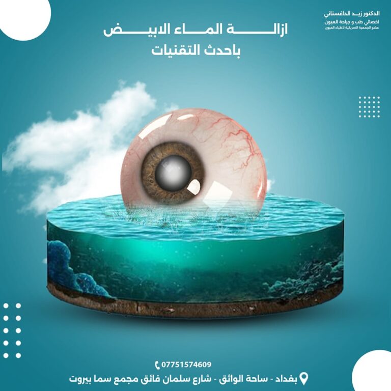 ازالة ماء العين 768x768