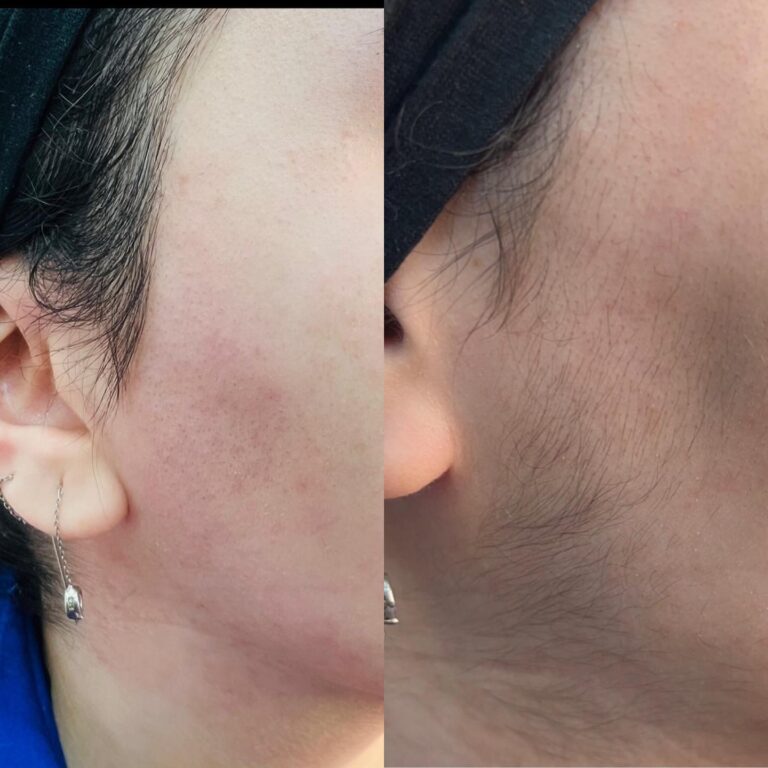 ازالة وجه 768x768