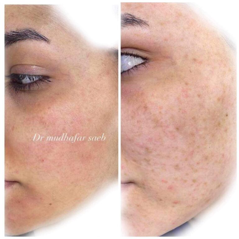 ازلة التصبغات 768x768